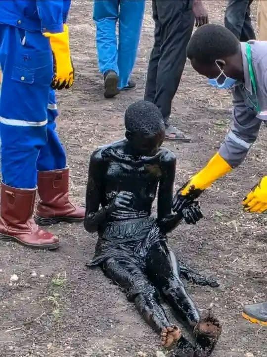 A woman being assisted after recovery from an oil waste site in Unity State